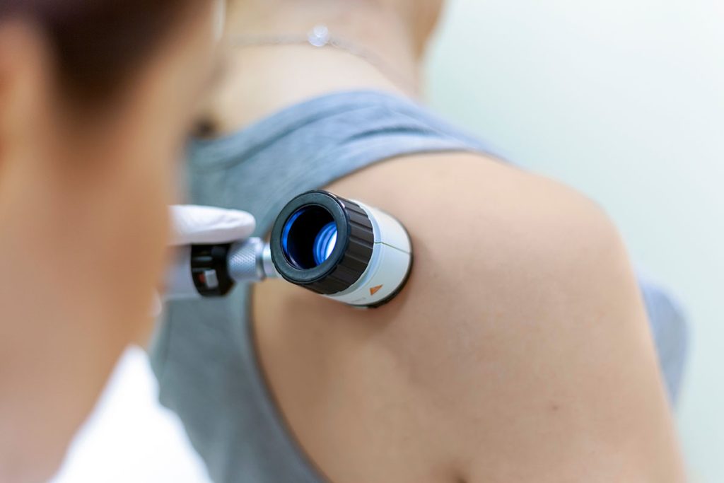 dermatologist examines mole