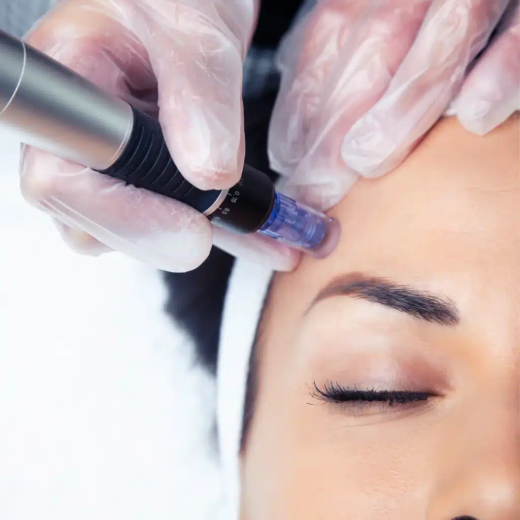 Microneedling vs HydraFacial
