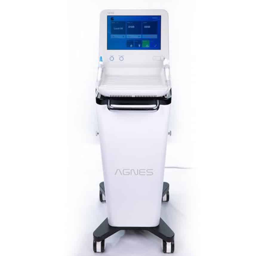 Agnes RF Treatment