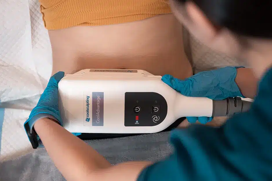 CoolSculpting in Singapore